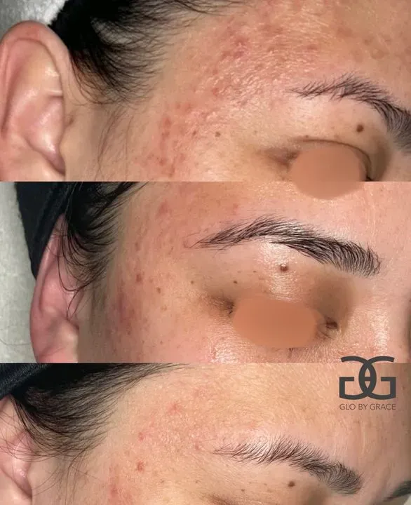 https://cdn.salonspotlight.com/photos/subpD0bjSPMf1BBrT2JG/73534861-db15-4f88-85f4-ce61e4af8b32_720x720