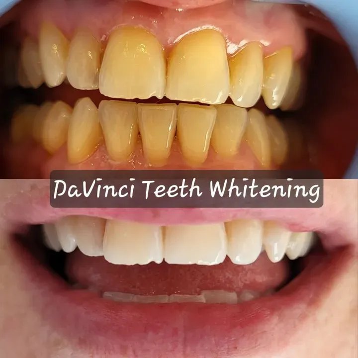 https://cdn.salonspotlight.com/photos/tURmFbITxnnixk2sDJSH/95915a02-54f1-44fb-9dcb-030f095adcde_720x720
