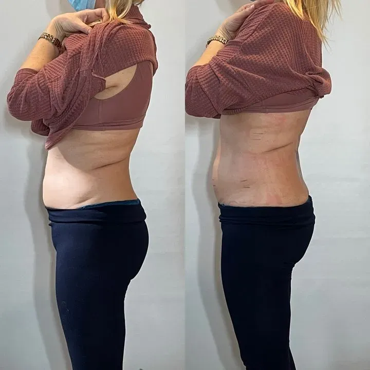 https://cdn.salonspotlight.com/photos/xqixFGRUc7CMzZw9Tw5c/95469c6d-1e8b-4e20-8d81-c7879ff6ad6b_720x720