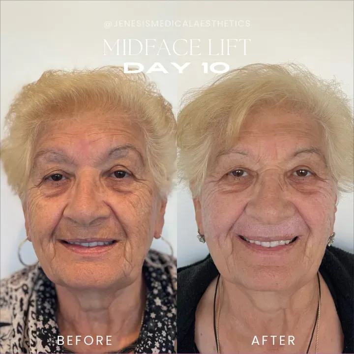https://cdn.salonspotlight.com/photos/y6gWRhZBWjw4S2Kc3zKd/042614b0-0332-49f9-9c50-98ab339ec4e7_720x720