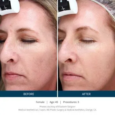 https://cdn.salonspotlight.com/photos/yg7rMSs5bgNy4lM44tUa/6410e3f2-dbd1-45f0-bc4d-962fb985b2c9_720x720