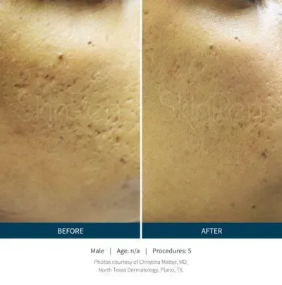 https://cdn.salonspotlight.com/photos/yg7rMSs5bgNy4lM44tUa/da15ad7f-c913-4fca-95e6-181fada00c7c_720x720