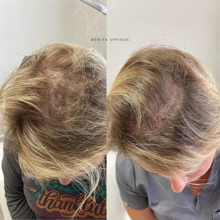 https://cdn.salonspotlight.com/photos/zkckVfVeGvcRYUy68BkU/06ea5343-2d1f-4302-9637-17addb5c498b_720x720